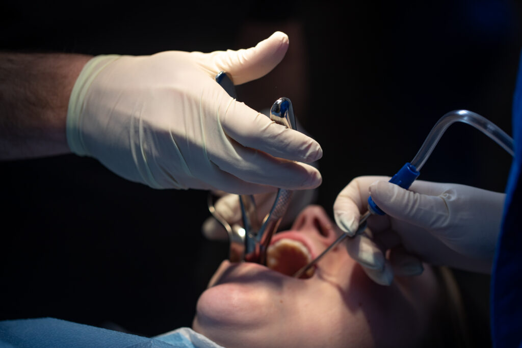 patient with tools in their mouth during wisdom tooth removal