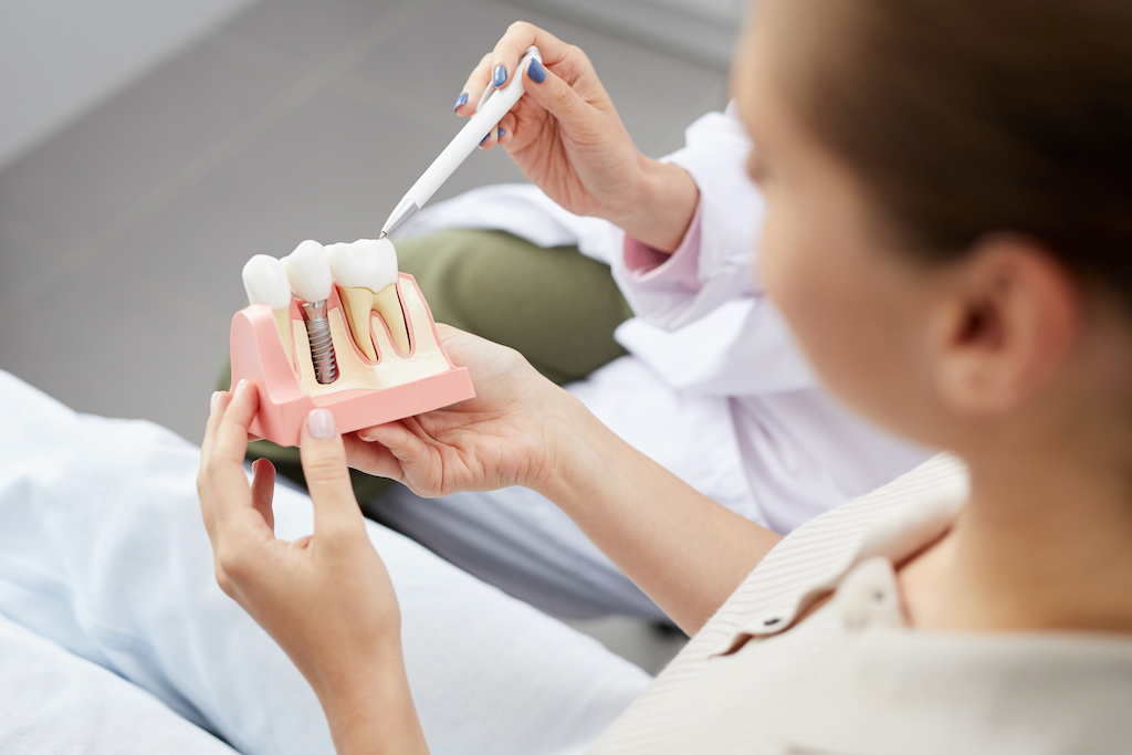 surgeon explaining dental implant model to a patient