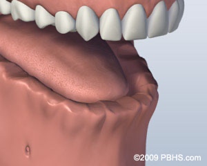 graphic of jaw missing lower teeth