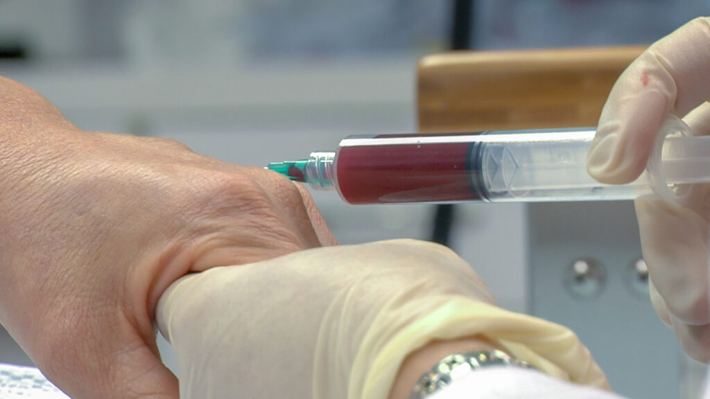 platelet rich plasma being injected into a hand