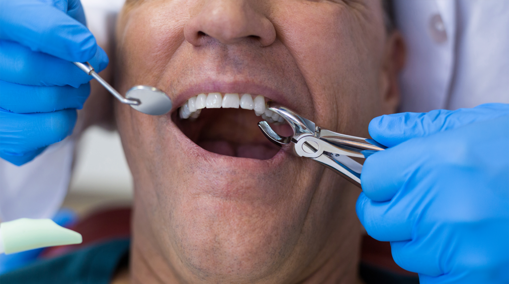 patient having a tooth extraction